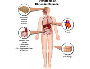 Intolerancia al gluten sintomas adultos