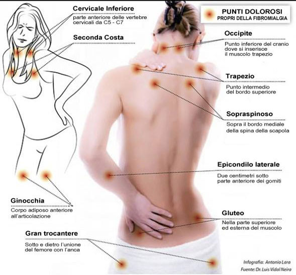 fibromialgia 1