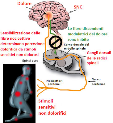 fibromialgia 4