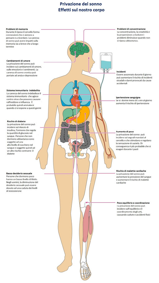 fibromialgia 9