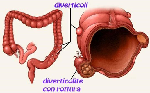 intestino 5 2019